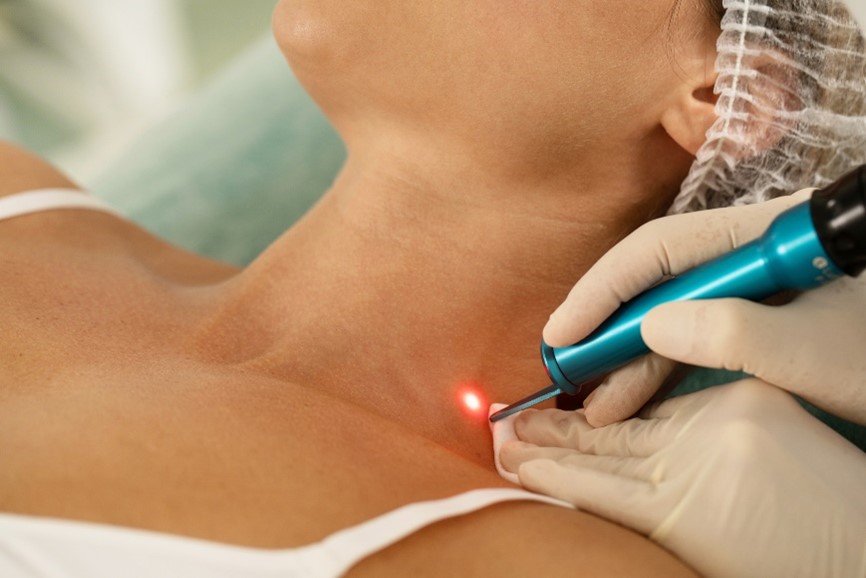 A person receiving laser treatment